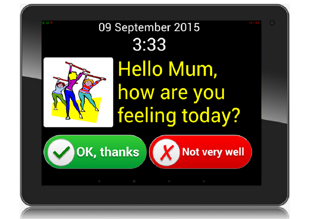 Reminder with a response request Reminder response